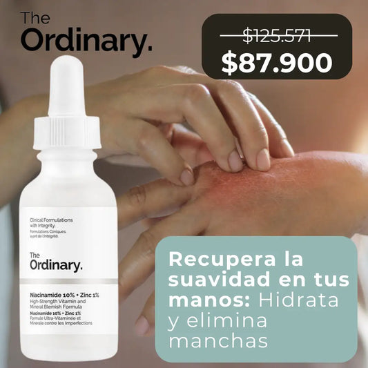 Manos Suaves y Sin Manchas con NiacidClear™: Fórmula Avanzada con Niacinamida